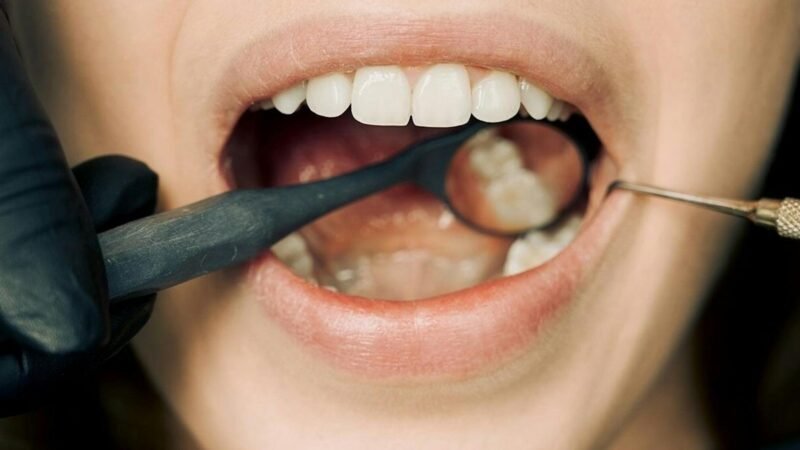 Sonhar com dente quebrado: o que significa?