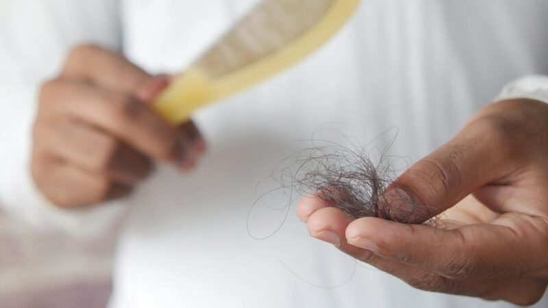 O que significa sonhar com cabelo caindo? Descubra aqui!